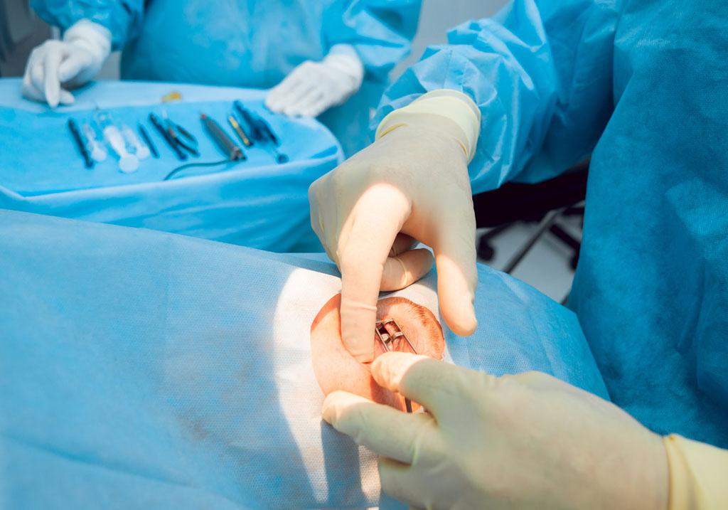 準分子和飛秒哪種手術方式的對眼睛更好