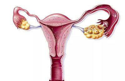 導致卵巢提前走向衰老的原因有哪些