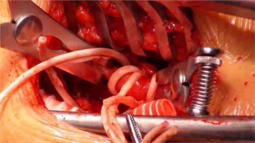 腦血管破裂時你的身體會慢慢顯出這七個體征