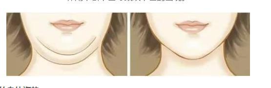 減雙下巴的運動方式