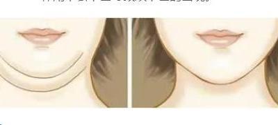 減雙下巴的運動方式