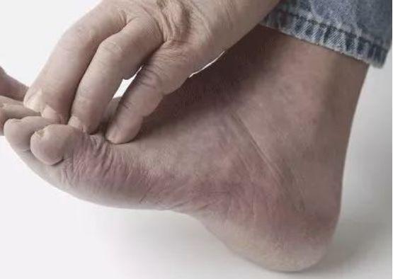 血糖到底高不高，看腳就知道！