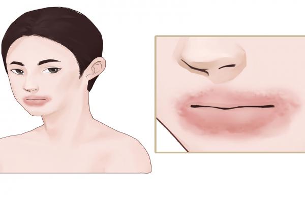 海鮮過敏的人能吃小龍蝦嗎 海鮮過敏的人適合吃什么食物