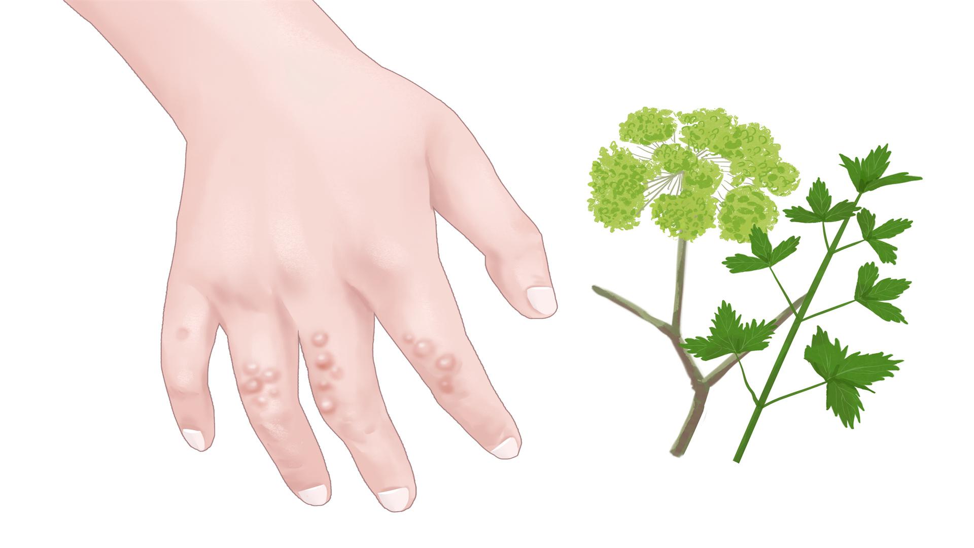 紅糖和山楂泡水喝能祛濕嗎 山楂的食用指南