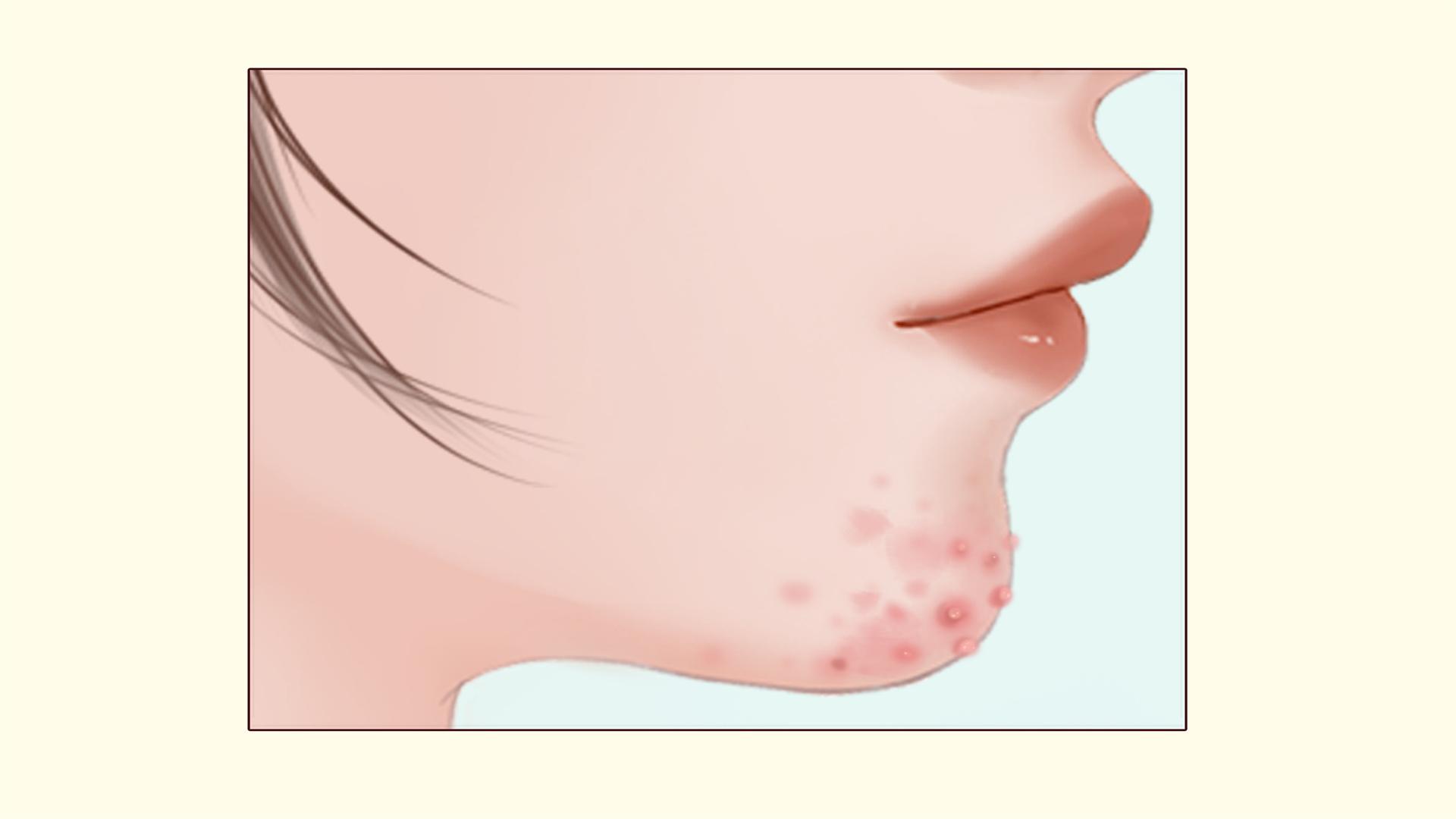 三伏天里該如何保養皮膚 三伏天護膚小妙招