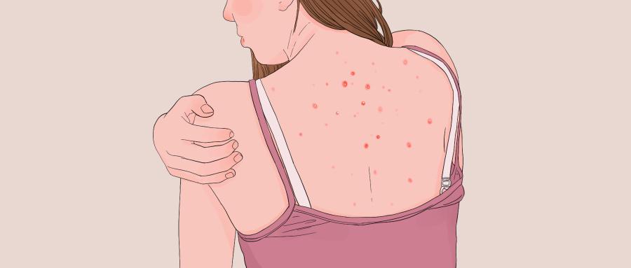 喝祛濕茶要多久有效果 祛濕茶的好處和作用