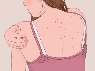 喝祛濕茶要多久有效果 祛濕茶的好處和作用