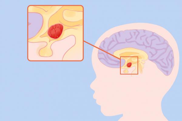 吃什么補(bǔ)腦增強(qiáng)記憶力