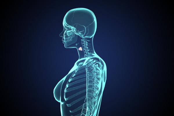 什么是橋本甲狀腺炎