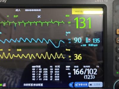 竇性心律不齊是指什么意思