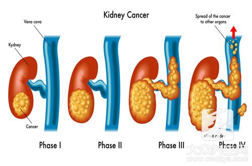 腎跟性功能有關系嗎