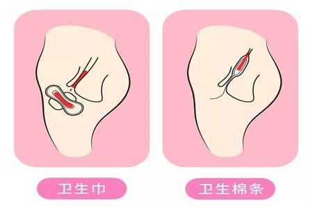 衛(wèi)生棉條解放女性自由 許多人卻擔(dān)心它會弄破處女膜？
