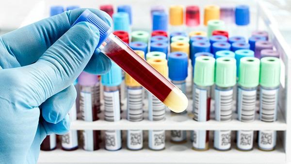 性激素六項檢查注意事項有哪些 性激素六項的參考范圍是什么