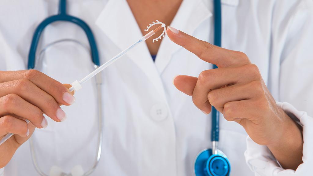 宮內節育環是什么 功能節育環的5個好處