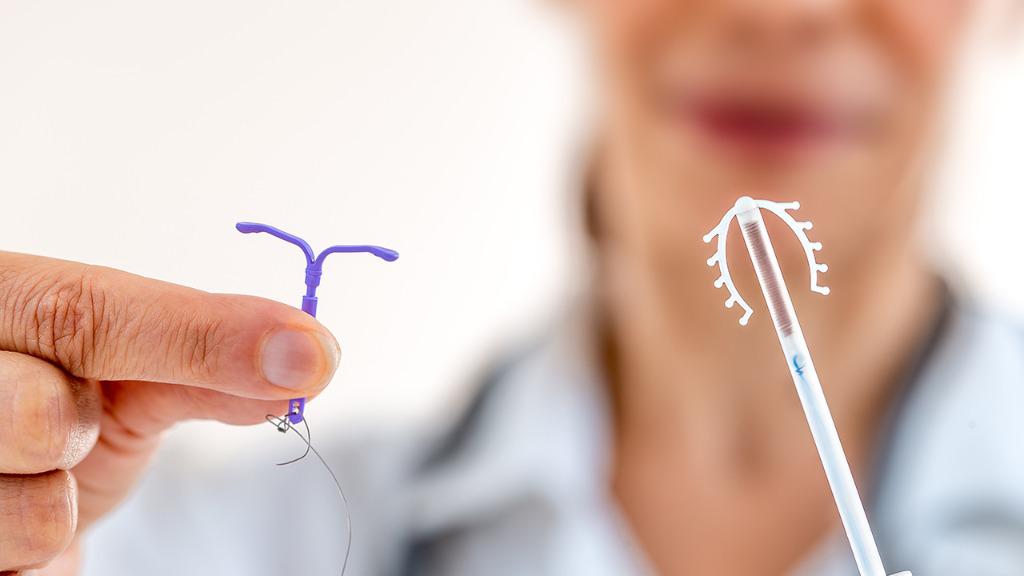 宮內節育環是什么 功能節育環的5個好處