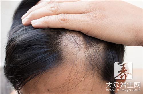 縱欲過度掉頭發(fā)還長(zhǎng)嗎-易網(wǎng)健康<a href=http://m.henggaotouzi.com/jkys/ target=_blank class=infotextkey>養(yǎng)生</a>網(wǎng) 縱欲過度掉頭發(fā)還長(zhǎng)嗎