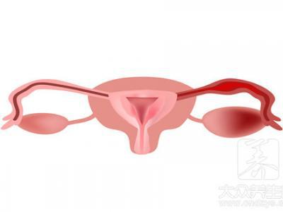 結(jié)扎恢復(fù)手術(shù)