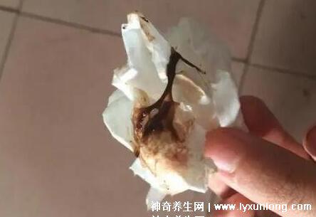 宮頸糜爛一二三度圖片，真實對比照片(小心是宮頸癌前兆)