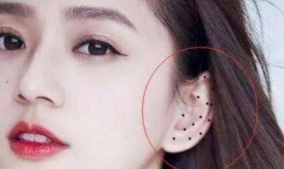 女人身上最好的16痣圖解大全，屁股有痣最富貴(位置與命運)