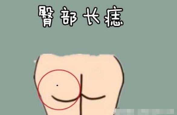 女人身上最好的16痣圖解大全，屁股有痣最富貴(位置與命運)