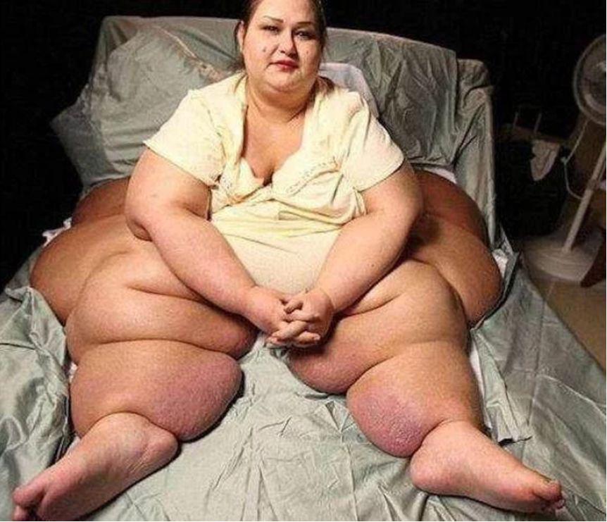 千斤女子暴瘦650斤，成功從生活不能自理到擁有姣好身材