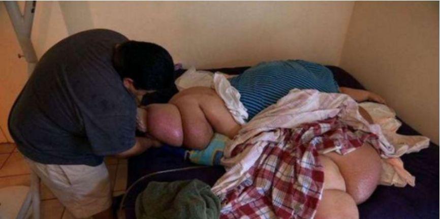 千斤女子暴瘦650斤，成功從生活不能自理到擁有姣好身材