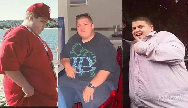 胖子成功減肥200斤，皮膚松弛也坦然面對！