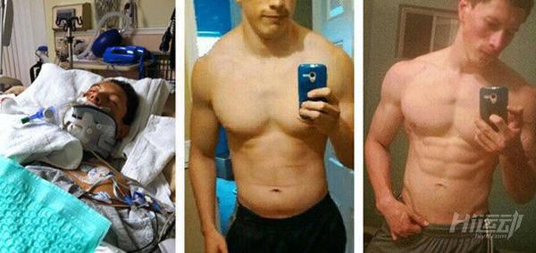 19歲小伙車禍后成殘廢！恢復性訓練重新站起來變型男