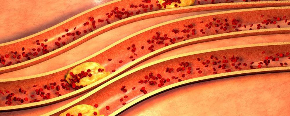 疫情期間去跑步 這幾點要注意