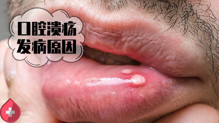 瘦身知識 喜歡也要克制 這7種食物容易導致消化不良