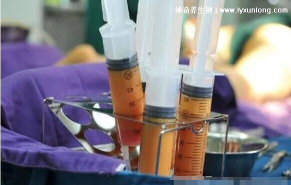 溶脂針多少錢一針能瘦多少，1千到5千元一針(國家為什么禁止打)