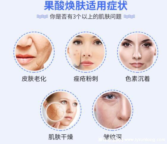 果酸換膚多少錢一次，1000-3000元不等(細(xì)致毛孔/淡化痘印)