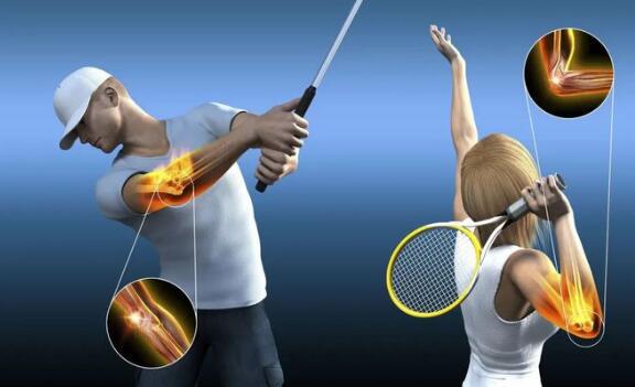 網球肘最怕三個動作，反手拍球/手腕彎曲/提重物/做家務