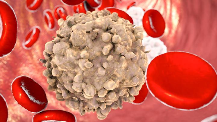 小產后能減肥嗎?小產后的注意事項有什么?-易網健康<a href=http://m.henggaotouzi.com/jkys/ target=_blank class=infotextkey>養生</a>網 小產后能減肥嗎?小產后的注意事項有什么?