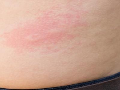 打籃球和跑步哪個減肥呢?減肥什么方法好？