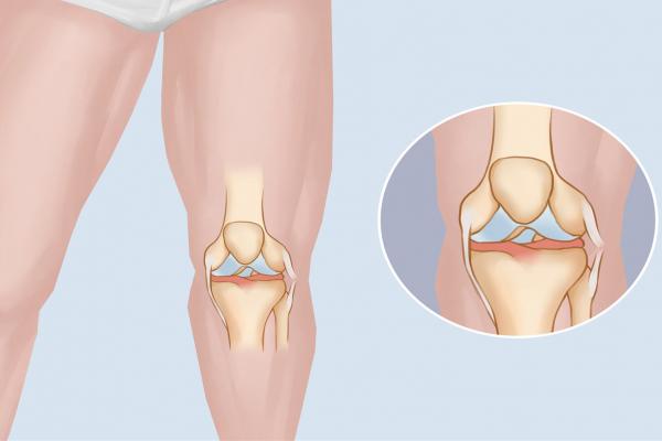 半馬對身體有損傷嗎