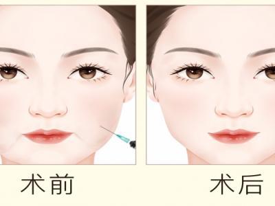 減肥溶脂針安全嗎