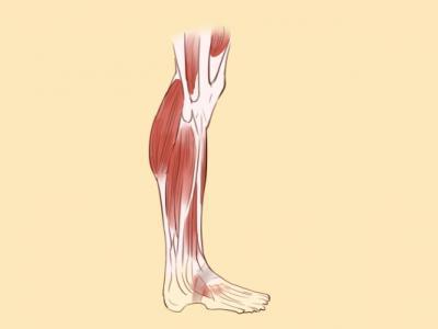 瘦小腿的方法有哪些