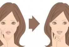 法令紋能去除嗎？去除法令紋的方法有哪些？