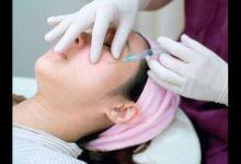 打玻尿酸要謹慎！或會留下這些后遺癥