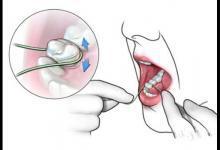 健康公開課：天天塞牙？使用牙線的“三步走”戰略送給你