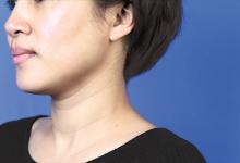 消除頸紋的按摩手法 一學(xué)就會