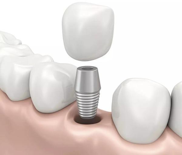 母親節禮物?送什么不如送媽媽一口好牙,義烏歐萊美口腔