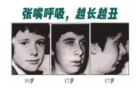 這些讓你變丑的習慣，再不改那可就沒救了！