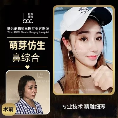 【隆鼻的“潛規則”】醫生是“看人收費的”？