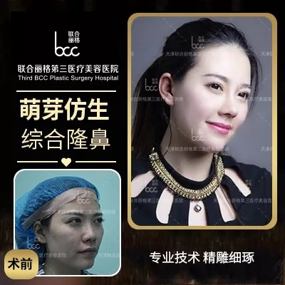 【隆鼻的“潛規則”】醫生是“看人收費的”？