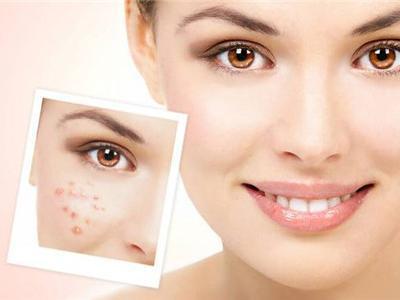 四大肌膚護理秘訣，生活護膚必備技能