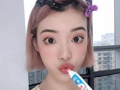 女性嘴巴容易長泡，反復性唇炎的預防和治療