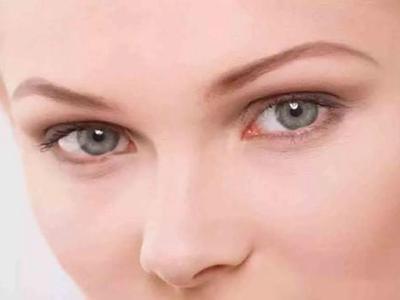 水腫、黑眼圈只是因為沒睡好？女性眼部問題潛藏的病癥