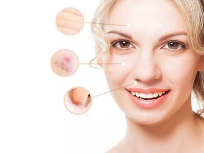 女性面部皮膚下垂怎么辦，四個方法延緩衰老